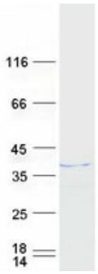 Coomassie blue staining of purified HNRNPH3 protein.